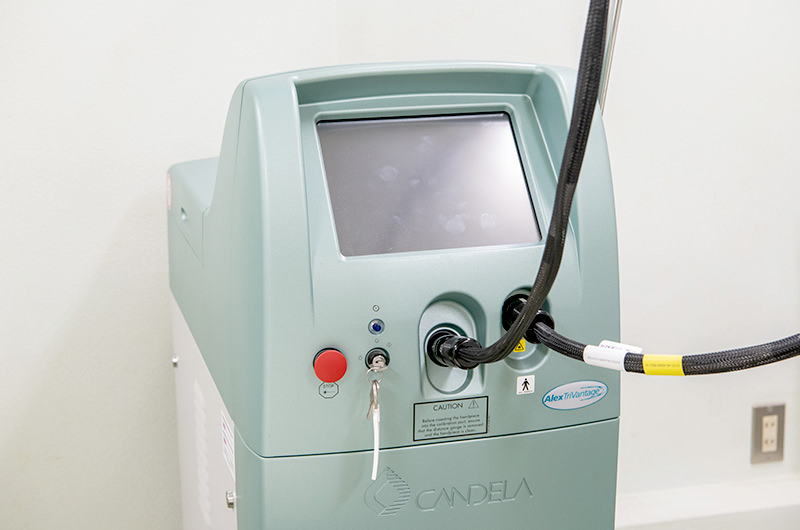 青アザやシミなどのお悩みに